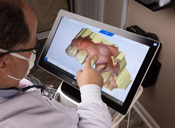 Dentist designing tooth using CAD CAM